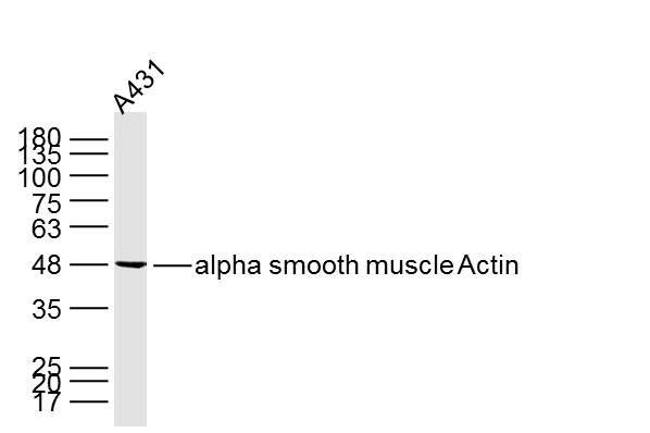 A431 cell lysate probed with ACTA2 (3F9) Monoclonal Antibody (bsm-33187M) at 1:300 overnight at 4°C followed by a conjugated secondary antibody at 1:10000 for 90 minutes at 37°C.