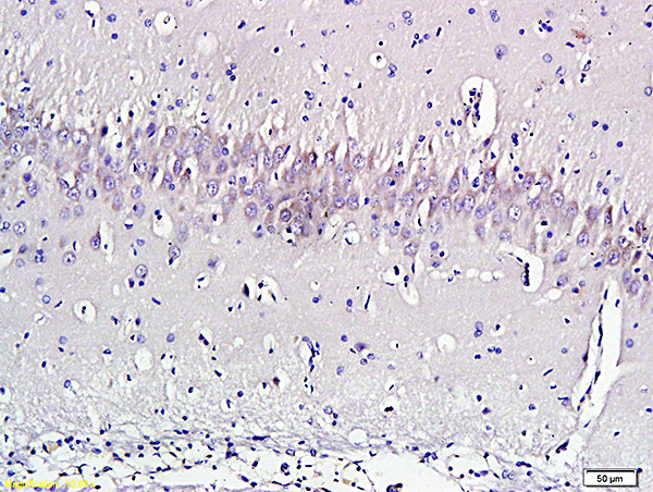 Formalin-fixed and paraffin embedded rat brain labeled with Anti-Nociceptin Polyclonal Antibody, Unconjugated(bs-0075R) 1:300 followed by conjugation to the secondary antibody and DAB staining