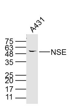 A431 cell lysates probed with PNSE (15E2) Monoclonal Antibody, unconjugated (bsm-33072M) at 1:300 overnight at 4°C followed by a conjugated secondary antibody for 60 minutes at 37°C._x000D_
