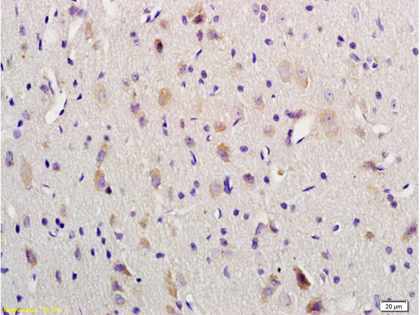 Formalin-fixed and paraffin embedded rat brain labeled with Anti-VIP Polyclonal Antibody, Unconjugated (bs-0077R) 1:200 followed by conjugation to the secondary antibody and DAB staining