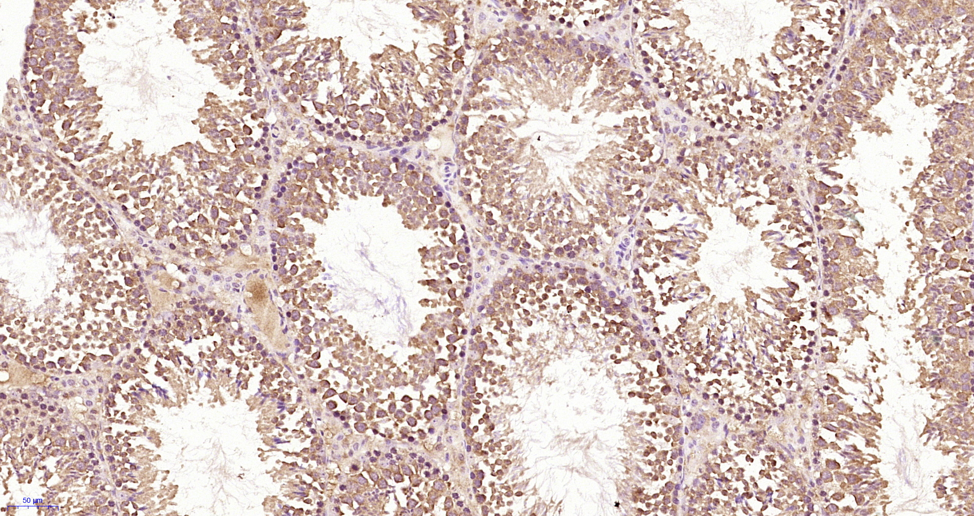 Paraformaldehyde-fixed, paraffin embedded Mouse testis; Antigen retrieval by boiling in sodium citrate buffer (pH6.0) for 15min; Block endogenous peroxidase by 3% hydrogen peroxide for 20 minutes; Blocking buffer (normal goat serum) at 37°C for 30min; Antibody incubation with NUP37 Polyclonal Antibody, Unconjugated (bs-7819R) at 1:400 overnight at 4°C, followed by a conjugated secondary and DAB staining. Paraformaldehyde-fixed, paraffin embedded Mouse testis; Antigen retrieval by boiling in sodium citrate buffer (pH6.0) for 15min; Block endogenous peroxidase by 3% hydrogen peroxide for 20 minutes; Blocking buffer (normal goat serum) at 37°C for 30min; Antibody incubation with NUP37 Polyclonal Antibody, Unconjugated (bs-7819R) at 1:400 overnight at 4°C, followed by a conjugated secondary and DAB staining.