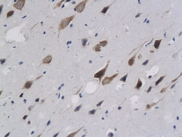 Formalin-fixed and paraffin embedded rat brain labeled with anti-Calponin 1/COLP Polyclonal Antibody (bs-0095R), Unconjugated followed by conjugation to the secondary antibody and DAB staining Formalin-fixed and paraffin embedded rat brain labeled with anti-Calponin 1/COLP Polyclonal Antibody (bs-0095R), Unconjugated followed by conjugation to the secondary antibody and DAB staining