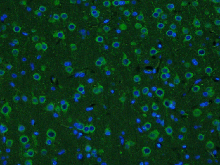 Paraformaldehyde-fixed, paraffin embedded rat brain; Antigen retrieval by boiling in sodium citrate buffer (pH6.0) for 15min; Block endogenous peroxidase by 3% hydrogen peroxide for 20 minutes; Blocking buffer (normal goat serum) at 37°C for 30min; Incubation: Anti- GDNF Antibody, conjugated (bs-1024R-FITC) 1:400, for 90 minutes at 37°C; DAPI (5ug/ml, blue) was used to stain the cell nuclei