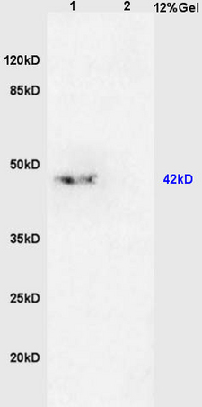 L1 mouse brain lysates, L2 mouse kidney lysates probed with Anti- TGF beta 2 Propeptide Polyclonal Antibody, Unconjugated (bs-0100R) at 1:200 in 4˚C. Followed by conjugation to secondary antibody (bs-0295G-HRP) at 1:3000 90min in 37˚C. Predicted band 12\/45kD Observed band size: 45kD