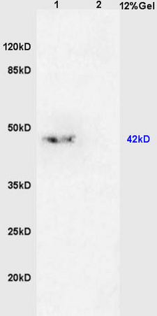 L1 mouse brain lysates, L2 mouse kidney lysates probed with Anti- TGF beta 2 Propeptide Polyclonal Antibody, Unconjugated (bs-0100R) at 1:200 in 4˚C. Followed by conjugation to secondary antibody (bs-0295G-HRP) at 1:3000 90min in 37˚C. Predicted band 12/45kD Observed band size: 45kD