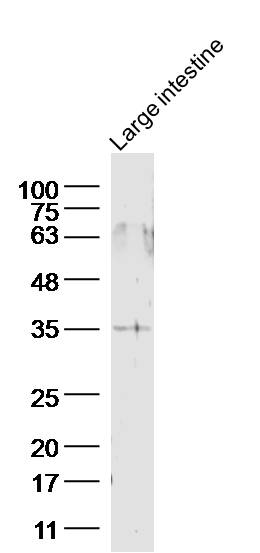 Mouse large intestine lysates; probed with GPR45 Polyclonal Antibody, unconjugated (bs-13538R) at 1:300 overnight at 4°C followed by a conjugated secondary antibody for 60 minutes at 37°C.