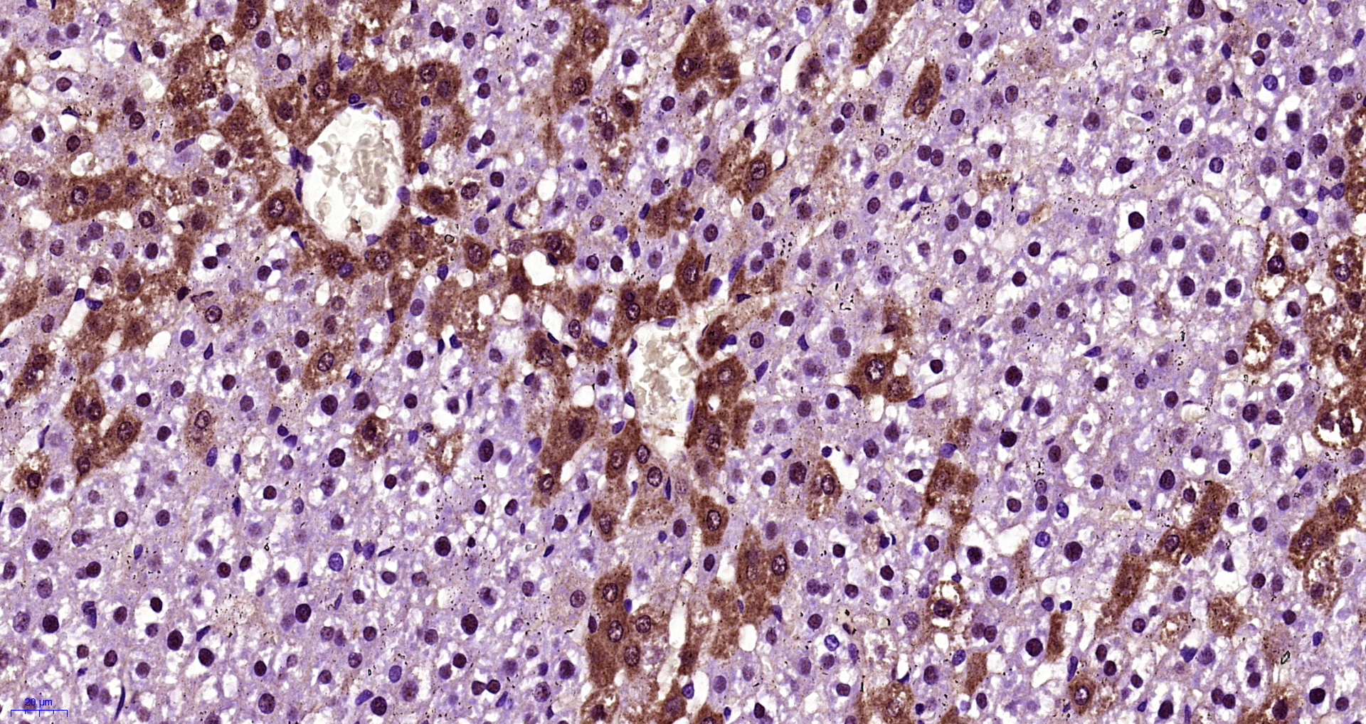 Paraformaldehyde-fixed, paraffin embedded rat liver; Antigen retrieval by boiling in sodium citrate buffer (pH6) for 15min; Block endogenous peroxidase by 3% hydrogen peroxide for 30 minutes; Blocking buffer (normal goat serum) at 37°C for 20min; Antibody incubation with FGF21 Polyclonal Antibody, Unconjugated (bs-2318R)at 1:400 overnight at 4°C, followed by a conjugated secondary and DAB staining.