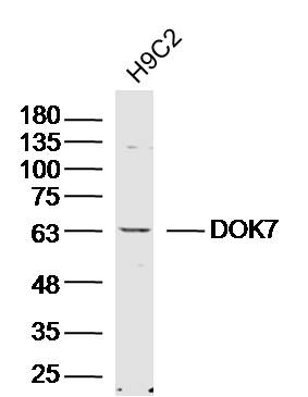 Lane 1: H9C2 lysates probed with DOK7 Polyclonal Antibody, Unconjugated (bs-13633R) at 1:300 overnight at 4˚C. Followed by a conjugated secondary antibody at 1:5000 for 90 min at 37˚C. Lane 1: H9C2 lysates probed with DOK7 Polyclonal Antibody, Unconjugated (bs-13633R) at 1:300 overnight at 4˚C. Followed by a conjugated secondary antibody at 1:5000 for 90 min at 37˚C.