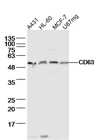 Lane 1: A431 lysates; Lane 2: HL-60 lysates; Lane 3: MCF-7 lysates; Lane 4: U97MG lysates probed with Anti –(Name) Polyclonal Antibody, Unconjugated (Catalog #) at 1:300 overnight at 4˚C. Followed by a conjugated secondary antibody at 1:5000 for 90 min at 37˚C.