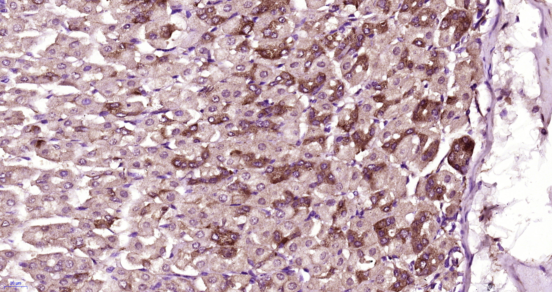 Paraformaldehyde-fixed, paraffin embedded Mouse stomach; Antigen retrieval by boiling in sodium citrate buffer (pH6.0) for 15min; Block endogenous peroxidase by 3% hydrogen peroxide for 20 minutes; Blocking buffer (normal goat serum) at 37°C for 30min; Antibody incubation with C1orf113 Polyclonal Antibody, Unconjugated (bs-15009R) at 1:400 overnight at 4°C, followed by a conjugated secondary and DAB staining.