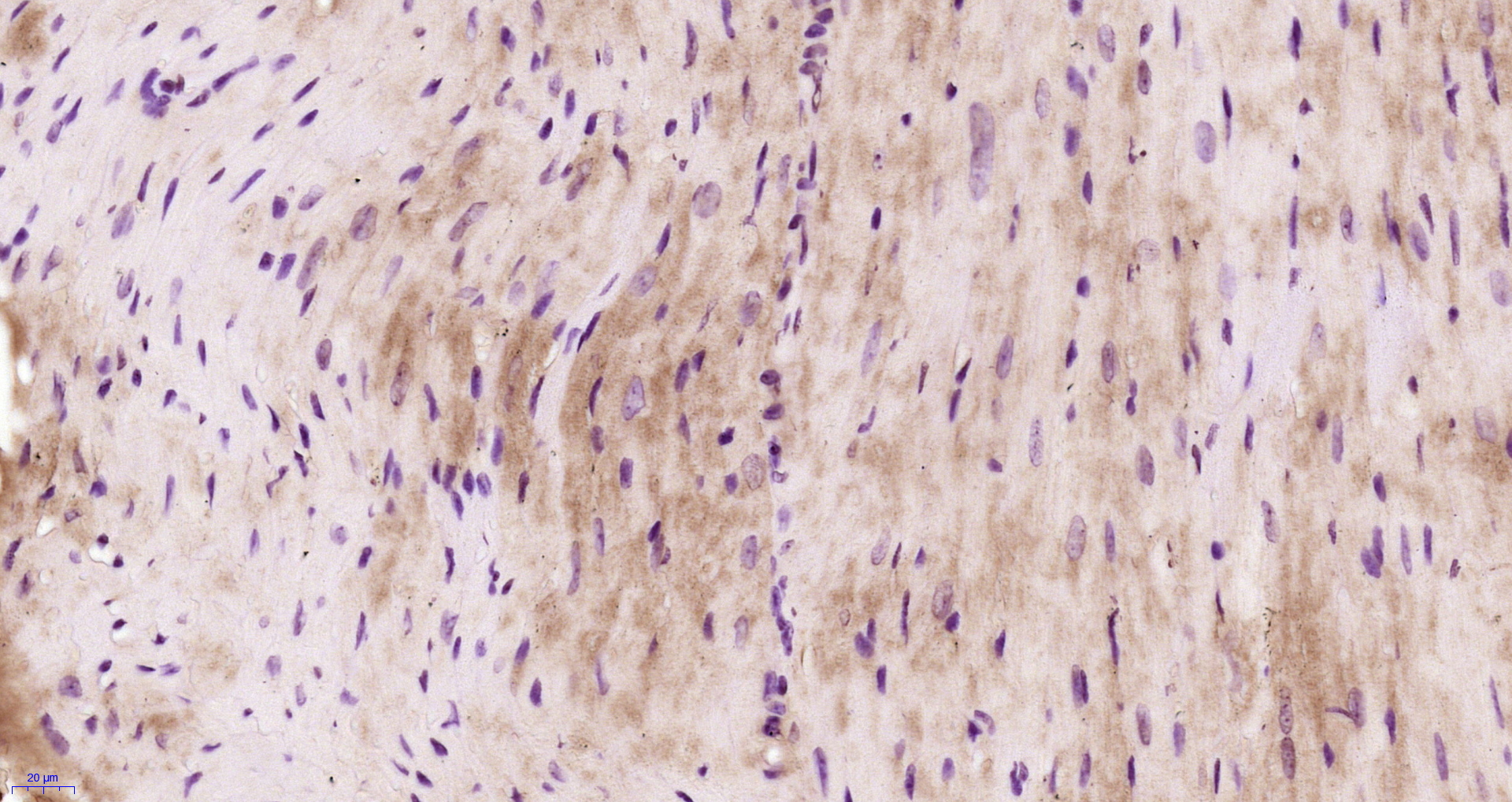 Paraformaldehyde-fixed, paraffin embedded Mouse heart; Antigen retrieval by boiling in sodium citrate buffer (pH6.0) for 15min; Block endogenous peroxidase by 3% hydrogen peroxide for 20 minutes; Blocking buffer (normal goat serum) at 37°C for 30min; Antibody incubation with Filamin 2 Polyclonal Antibody, Unconjugated (bs-13182R) at 1:400 overnight at 4°C, followed by a conjugated secondary and DAB staining.