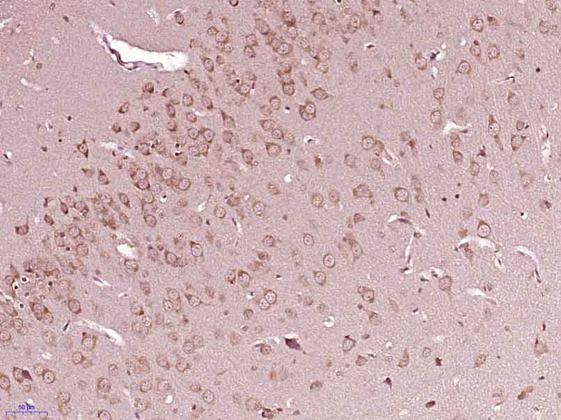 Paraformaldehyde-fixed, paraffin embedded rat brain; Antigen retrieval by boiling in sodium citrate buffer (pH6) for 15min; Block endogenous peroxidase by 3% hydrogen peroxide for 30 minutes; Blocking buffer (normal goat serum) at 37°C for 20min; Antibody incubation with SRC Polyclonal Antibody, Unconjugated (bs-1135R) at 1:400 overnight at 4°C, followed by a conjugated secondary and DAB staining.