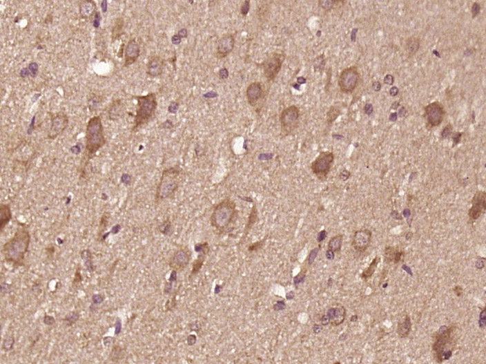 Paraformaldehyde-fixed, paraffin embedded rat brain; Antigen retrieval by boiling in sodium citrate buffer (pH6) for 15min; Block endogenous peroxidase by 3% hydrogen peroxide for 30 minutes; Blocking buffer (normal goat serum) at 37°C for 20min; Antibody incubation with IL-12 alpha Polyclonal Antibody, Unconjugated (bs-0767R) at 1:400 overnight at 4°C, followed by a conjugated secondary and DAB staining.