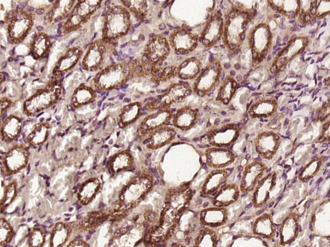 Paraformaldehyde-fixed, paraffin embedded rat kidney; Antigen retrieval by boiling in sodium citrate buffer (pH6) for 15min; Block endogenous peroxidase by 3% hydrogen peroxide for 30 minutes; Blocking buffer (normal goat serum) at 37°C for 20min; Antibody incubation with CDK4 Polyclonal Antibody, Unconjugated (bs-0633R) at 1:400 overnight at 4°C, followed by a conjugated secondary and DAB staining.