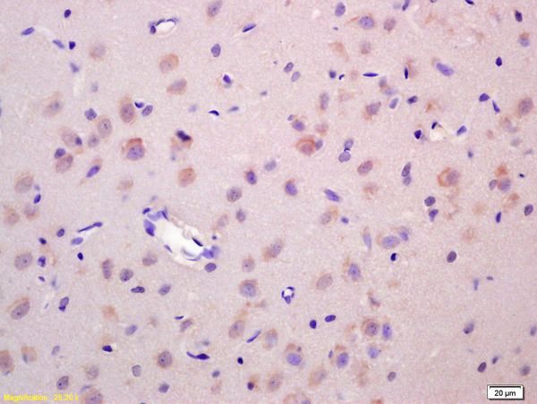Formalin-fixed and paraffin embedded rat brain labeled with Anti-Wnt1 Polyclonal Antibody, Unconjugated (bs-1739R) at 1:200 followed by conjugation to the secondary antibody and DAB staining.