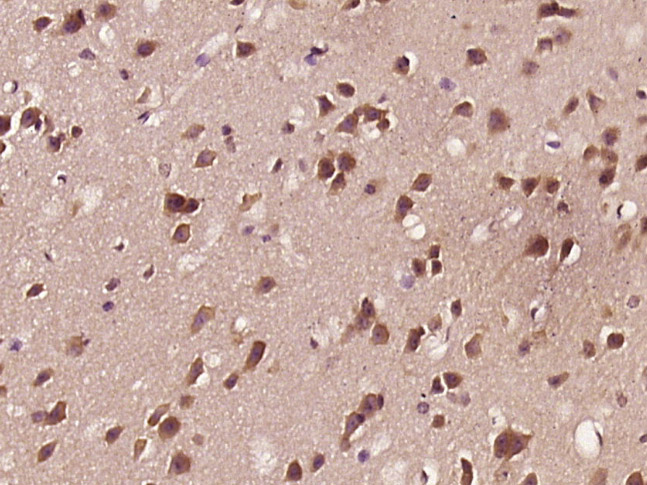Paraformaldehyde-fixed, paraffin embedded mouse brain; Antigen retrieval by boiling in sodium citrate buffer (pH6) for 15min; Block endogenous peroxidase by 3% hydrogen peroxide for 30 minutes; Blocking buffer (normal goat serum) at 37°C for 20min; Antibody incubation with APBB1 (Ser175) Polyclonal Antibody, Unconjugated (bs-5165R) at 1:400 overnight at 4°C, followed by a conjugated secondary and DAB staining.