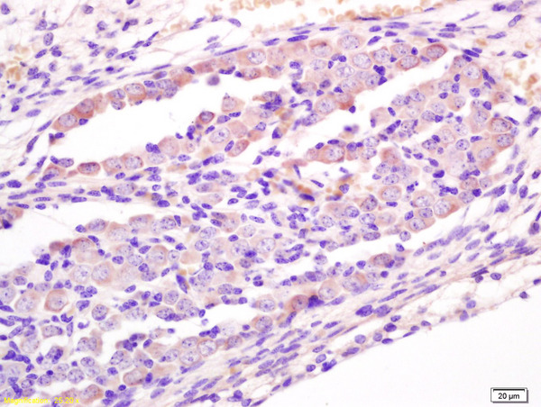 Formalin-fixed and paraffin embedded mouse embryo labeled with Anti-Wnt1 Polyclonal Antibody, Unconjugated (bs-1739R) at 1:200 followed by conjugation to the secondary antibody and DAB staining.