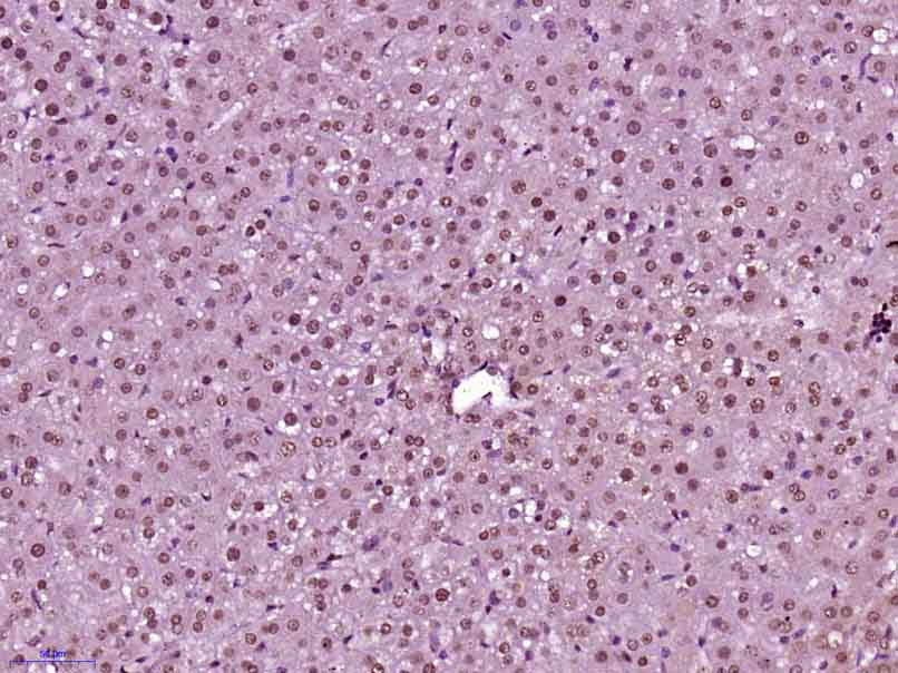 Paraformaldehyde-fixed, paraffin embedded rat liver; Antigen retrieval by boiling in sodium citrate buffer (pH6) for 15min; Block endogenous peroxidase by 3% hydrogen peroxide for 30 minutes; Blocking buffer (normal goat serum) at 37°C for 20min; Antibody incubation with CDKN1A (Thr145) Polyclonal Antibody, Unconjugated (bs-5237R) at 1:200 overnight at 4°C, followed by a conjugated secondary and DAB staining.