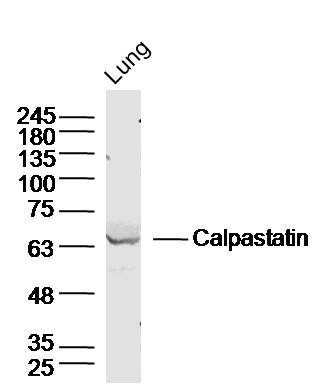 Mouse lung lysates probed with Calpastatin Polyclonal Antibody, unconjugated (bs-6701R) at 1:300 overnight at 4°C followed by a conjugated secondary antibody for 60 minutes at 37°C.