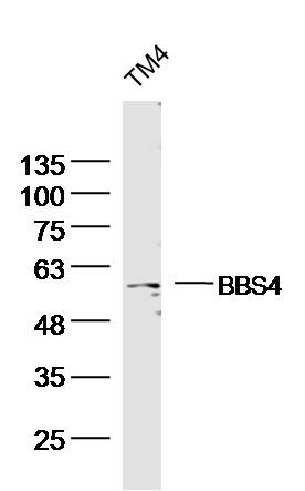 TM4 Mouse Cell lysates probed with BBS4 Polyclonal Antibody, unconjugated (bs-11508R) at 1:300 overnight at 4°C followed by a conjugated secondary antibody for 60 minutes at 37°C.