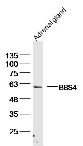 Mouse adrenal gland lysates probed with BBS4 Polyclonal Antibody, unconjugated (bs-11508R) at 1:300 overnight at 4°C followed by a conjugated secondary antibody for 60 minutes at 37°C.