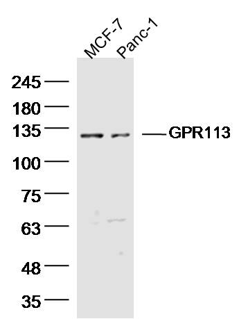 Lane 1: MCF-7 Cell lysates; Lane 2: Panc-1 Cell lysates; probed with GPR113 Polyclonal Antibody, unconjugated (bs-15375R) at 1:300 overnight at 4°C followed by a conjugated secondary antibody for 60 minutes at 37°C.