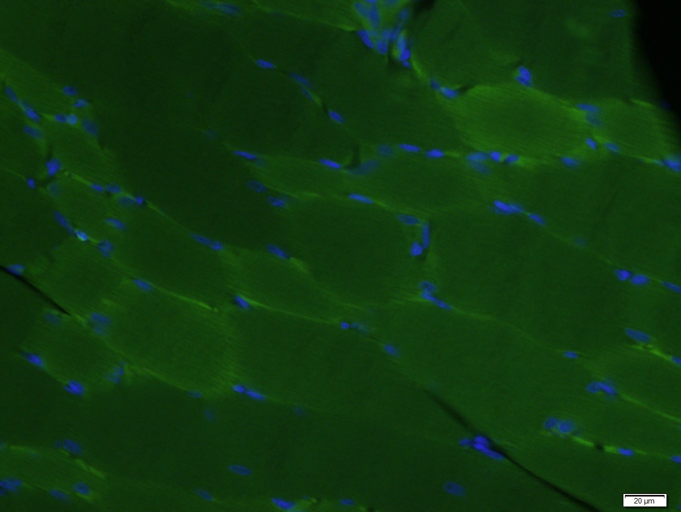 Paraformaldehyde-fixed, paraffin embedded rat skeletal muscle; Antigen retrieval by boiling in sodium citrate buffer (pH6.0) for 15min; Block endogenous peroxidase by 3% hydrogen peroxide for 20 minutes; Blocking buffer (normal goat serum) at 37°C for 30min; Antibody incubation with COX4 Monoclonal Antibody, Unconjugated (bsm-33037M) at 1:400 overnight at 4°C, followed by a conjugated Goat Anti-Mouse IgG antibody (bs-0296G-FITC) for 90 minutes, and DAPI for nuclei staining.