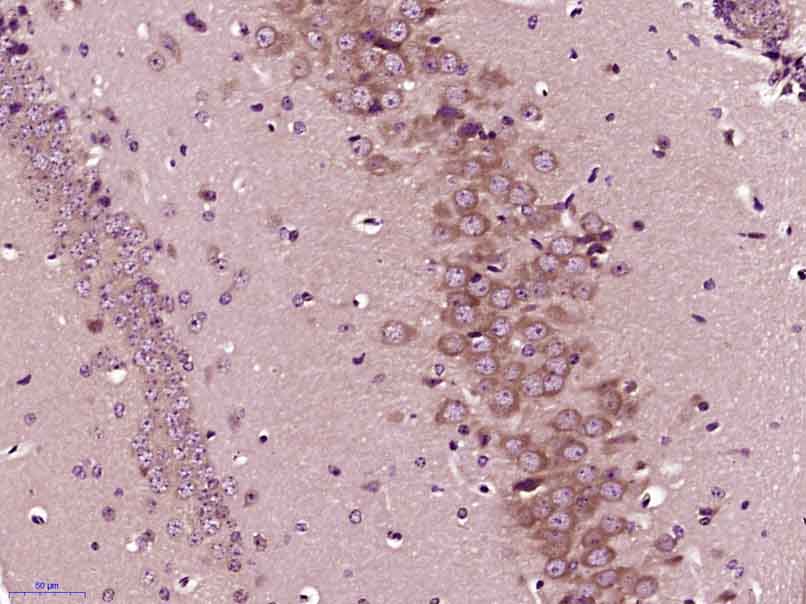 Paraformaldehyde-fixed, paraffin embedded mouse brain; Antigen retrieval by boiling in sodium citrate buffer (pH6) for 15min; Block endogenous peroxidase by 3% hydrogen peroxide for 30 minutes;  Blocking buffer (normal goat serum) at 37\u00b0C for 20min; Antibody incubation with PP2A alpha + beta Polyclonal Antibody, Unconjugated (bs-0029R)at 1:400 overnight at 4\u00b0C, followed by a conjugated secondary and DAB staining.