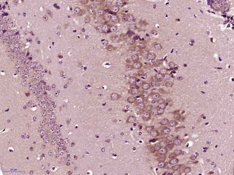 Paraformaldehyde-fixed, paraffin embedded mouse brain; Antigen retrieval by boiling in sodium citrate buffer (pH6) for 15min; Block endogenous peroxidase by 3% hydrogen peroxide for 30 minutes; Blocking buffer (normal goat serum) at 37°C for 20min; Antibody incubation with PP2A alpha + beta Polyclonal Antibody, Unconjugated (bs-0029R)at 1:400 overnight at 4°C, followed by a conjugated secondary and DAB staining.