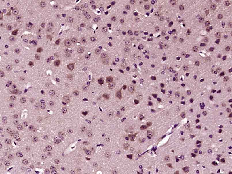Paraformaldehyde-fixed, paraffin embedded mouse brain; Antigen retrieval by boiling in sodium citrate buffer (pH6) for 15min; Block endogenous peroxidase by 3% hydrogen peroxide for 30 minutes; Blocking buffer (normal goat serum) at 37°C for 20min; Antibody incubation with SFRP1 Polyclonal Antibody, Unconjugated (bs-1303R) at 1:200 overnight at 4°C, followed by a conjugated secondary and DAB staining.