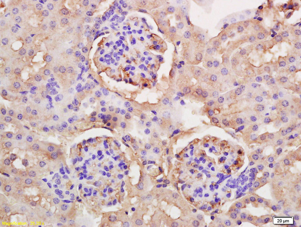 Formalin-fixed and paraffin embedded mouse liver labeled with Anti-PPARGC1A/PGC1 alpha Polyclonal Antibody, Unconjugated (bs-1832R) at 1:200 followed by conjugation to the secondary antibody and DAB staining.