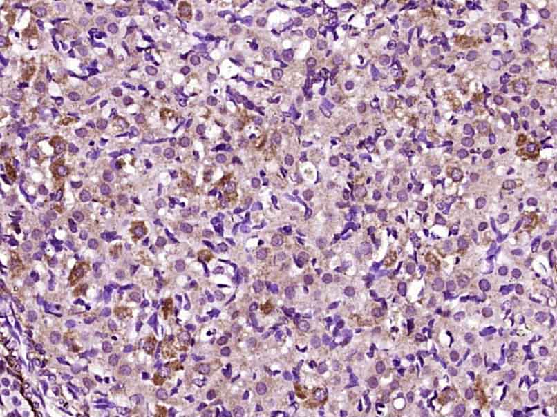 Paraformaldehyde-fixed, paraffin embedded rat ovary; Antigen retrieval by boiling in sodium citrate buffer (pH6) for 15min; Block endogenous peroxidase by 3% hydrogen peroxide for 30 minutes; Blocking buffer (normal goat serum) at 37°C for 20min; Antibody incubation with GDF9 Polyclonal Antibody, Unconjugated (bs-4720R) at 1:200 overnight at 4°C, followed by a conjugated secondary and DAB staining.
