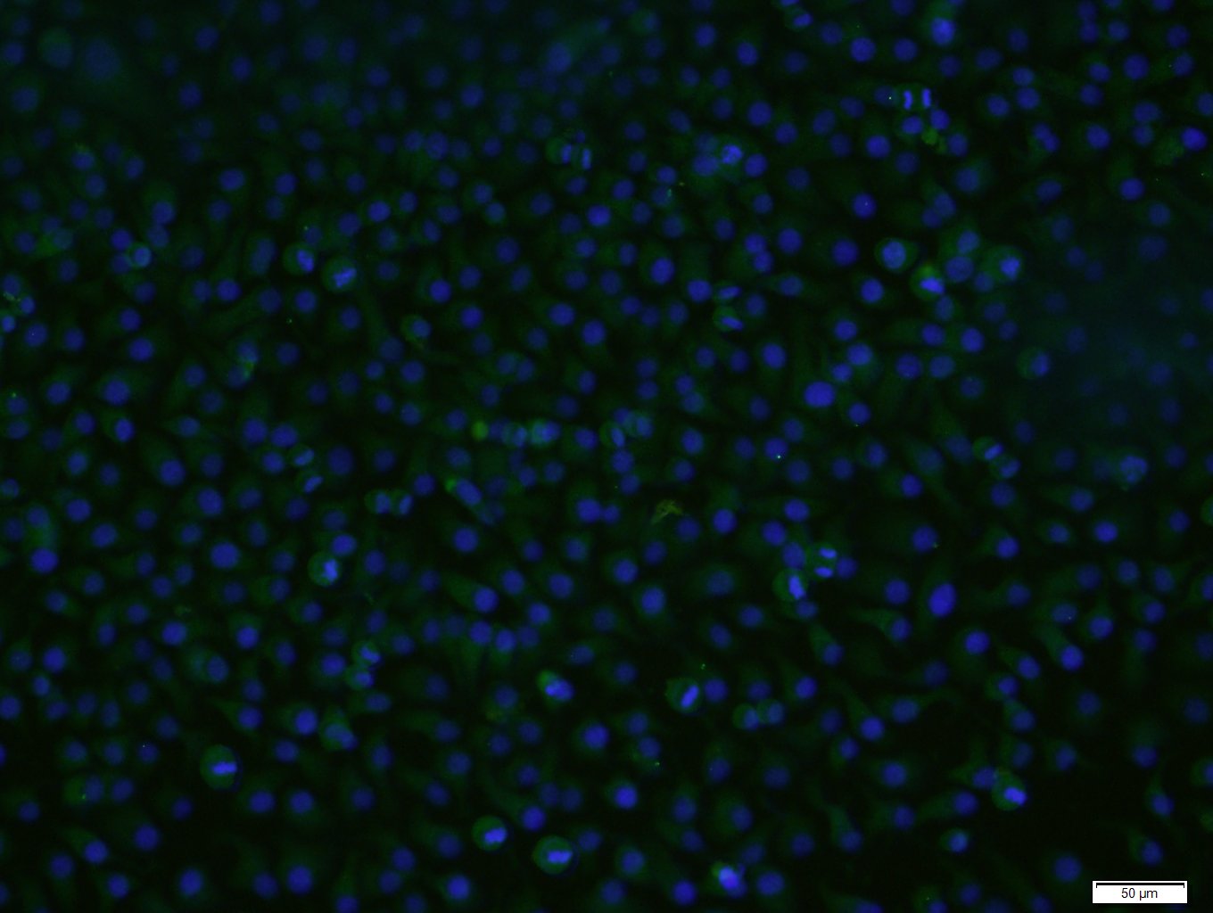 HepG2 cells were stained with Caspase 9 Polyclonal Antibody, Unconjugated (bs-0049R) at 1:200 in PBS and incubated for two hours at 37\u00b0C followed by Goat Anti-Rabbit IgG (H+L), FITC conjugated secondary antibody. DAPI staining of the nucleus in blue. 