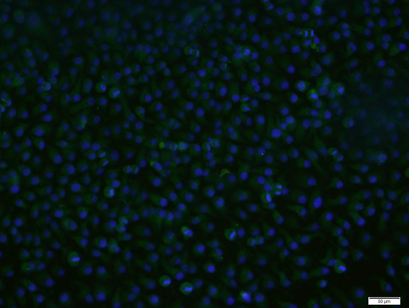 HepG2 cells were stained with Caspase 9 Polyclonal Antibody, Unconjugated (bs-0049R) at 1:200 in PBS and incubated for two hours at 37°C followed by Goat Anti-Rabbit IgG (H+L), FITC conjugated secondary antibody. DAPI staining of the nucleus in blue.
