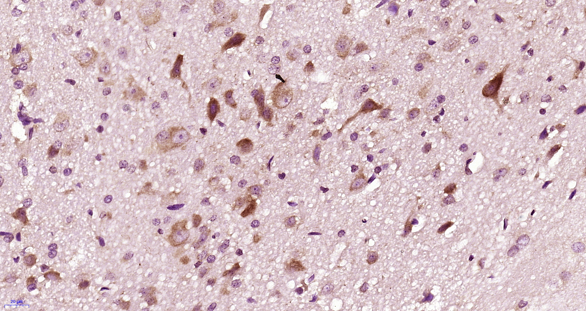 Paraformaldehyde-fixed, paraffin embedded rat brain; Antigen retrieval by boiling in sodium citrate buffer (pH6.0) for 15min; Block endogenous peroxidase by 3% hydrogen peroxide for 20 minutes; Blocking buffer (normal goat serum) at 37°C for 30min; Antibody incubation with DRD2 Polyclonal Antibody Polyclonal Antibody, Unconjugated (bs-1008R) at 1:400 overnight at 4°C, followed by an SP Kit (Rabbit) and DAB staining.