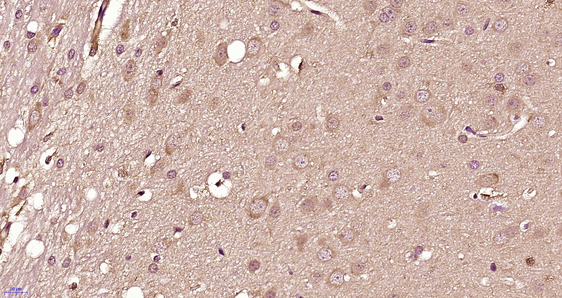 Paraformaldehyde-fixed, paraffin embedded rat brain; Antigen retrieval by boiling in sodium citrate buffer (pH6) for 15min; Block endogenous peroxidase by 3% hydrogen peroxide for 30 minutes; Blocking buffer (normal goat serum) at 37°C for 20min; Antibody incubation with DRD3 Polyclonal Antibody, Unconjugated (bs-1743R) at 1:400 overnight at 4°C, followed by a conjugated secondary and DAB staining. Paraformaldehyde-fixed, paraffin embedded rat brain; Antigen retrieval by boiling in sodium citrate buffer (pH6) for 15min; Block endogenous peroxidase by 3% hydrogen peroxide for 30 minutes; Blocking buffer (normal goat serum) at 37°C for 20min; Antibody incubation with DRD3 Polyclonal Antibody, Unconjugated (bs-1743R) at 1:400 overnight at 4°C, followed by a conjugated secondary and DAB staining.