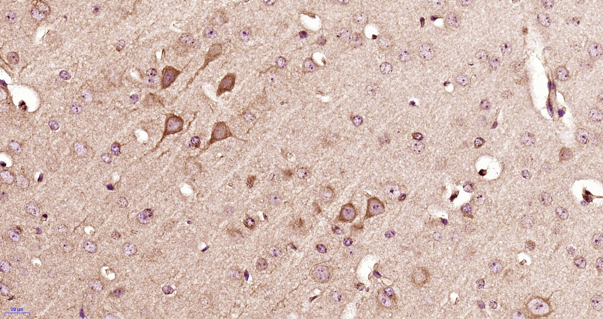 Paraformaldehyde-fixed, paraffin embedded mouse brain; Antigen retrieval by boiling in sodium citrate buffer (pH6) for 15min; Block endogenous peroxidase by 3% hydrogen peroxide for 30 minutes;  Blocking buffer (normal goat serum) at 37\u00b0C for 20min; Antibody incubation with 14-3-3 beta Polyclonal Antibody, Unconjugated (bs-12420R) at 1:400 overnight at 4\u00b0C, followed by a conjugated secondary and DAB staining.