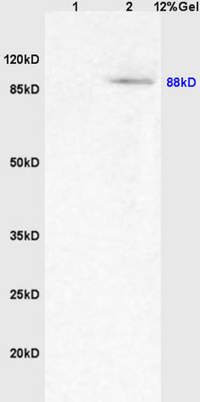 L1 rat brain lysates L2 rat kidney lysates probed with Anti PPARGC1A/PGC1 alpha Polyclonal Antibody, Unconjugated (bs-1832R) at 1:200 overnight at 4˚C. Followed by conjugation to secondary antibody (bs-0295G-HRP) at 1:3000 for 90 min at 37˚C. Predicted band 88kD. Observed band size:88kD.\n