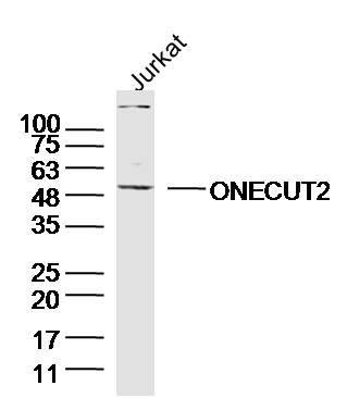 Jurkay lysates probed with ONECUT2 Polyclonal Antibody, Unconjugated (bs-19643R) at 1:300 overnight at 4˚C. Followed by a conjugated secondary antibody at 1:5000 for 90 min at 37˚C.