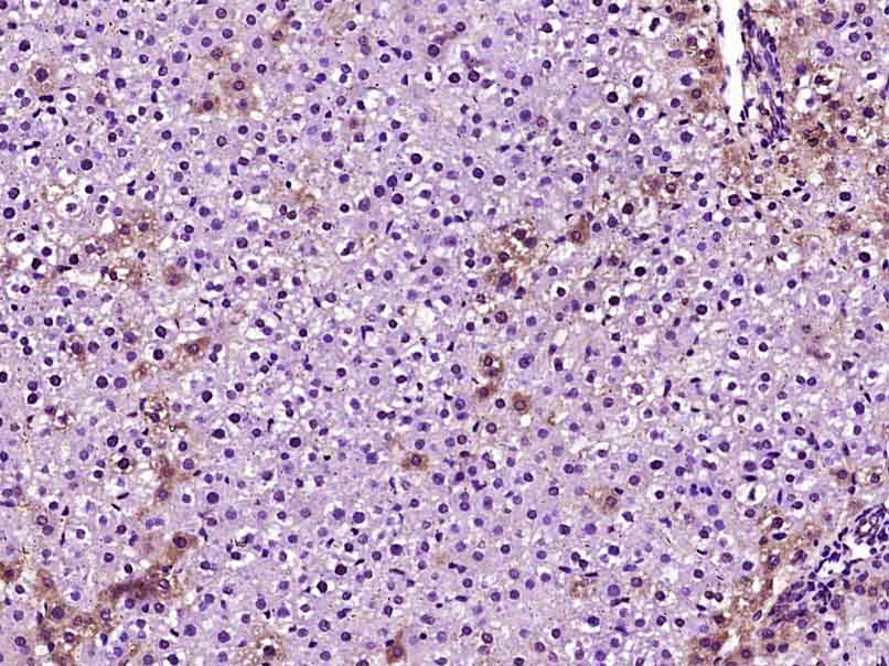 Paraformaldehyde-fixed, paraffin embedded rat liver; Antigen retrieval by boiling in sodium citrate buffer (pH6) for 15min; Block endogenous peroxidase by 3% hydrogen peroxide for 30 minutes; Blocking buffer (normal goat serum) at 37°C for 20min; Antibody incubation with Apolipoprotein E Polyclonal Antibody, Unconjugated (bs-4892R) at 1:400 overnight at 4°C, followed by a conjugated secondary and DAB staining.