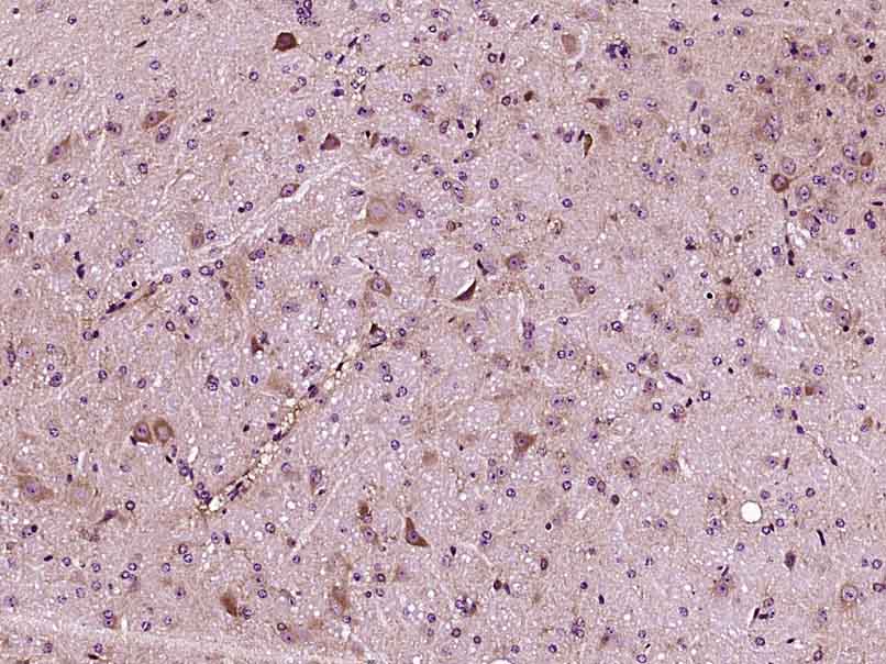 Paraformaldehyde-fixed, paraffin embedded mouse brain; Antigen retrieval by boiling in sodium citrate buffer (pH6) for 15min; Block endogenous peroxidase by 3% hydrogen peroxide for 30 minutes; Blocking buffer (normal goat serum) at 37°C for 20min; Antibody incubation with Apolipoprotein E Polyclonal Antibody, Unconjugated (bs-4892R) at 1:400 overnight at 4°C, followed by a conjugated secondary and DAB staining.