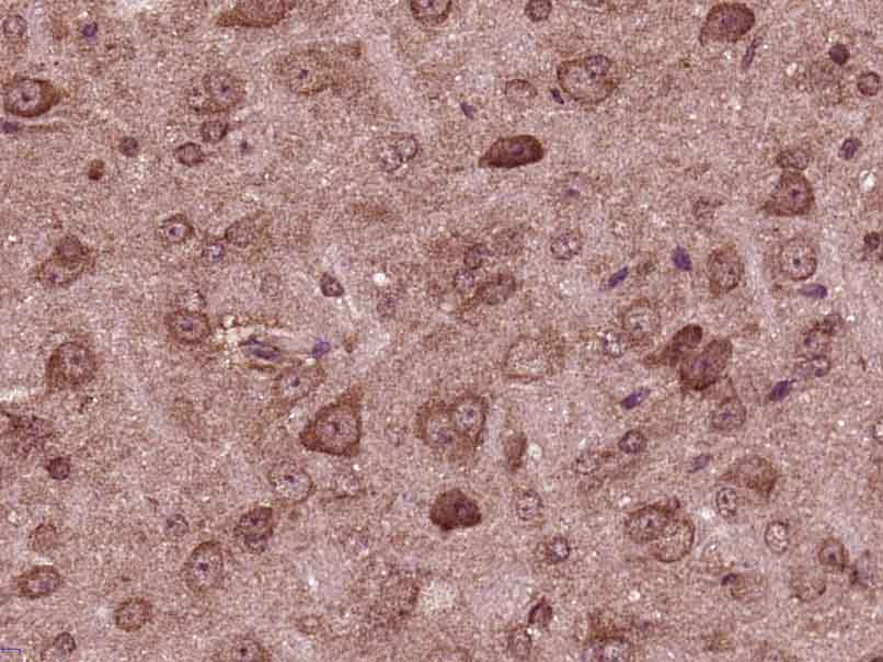 Paraformaldehyde-fixed, paraffin embedded mouse brain; Antigen retrieval by boiling in sodium citrate buffer (pH6) for 15min; Block endogenous peroxidase by 3% hydrogen peroxide for 30 minutes; Blocking buffer (normal goat serum) at 37°C for 20min; Antibody incubation with AMPK alpha-1 Polyclonal Antibody, Unconjugated (bs-10344R) at 1:400 overnight at 4°C, followed by a conjugated secondary and DAB staining.
