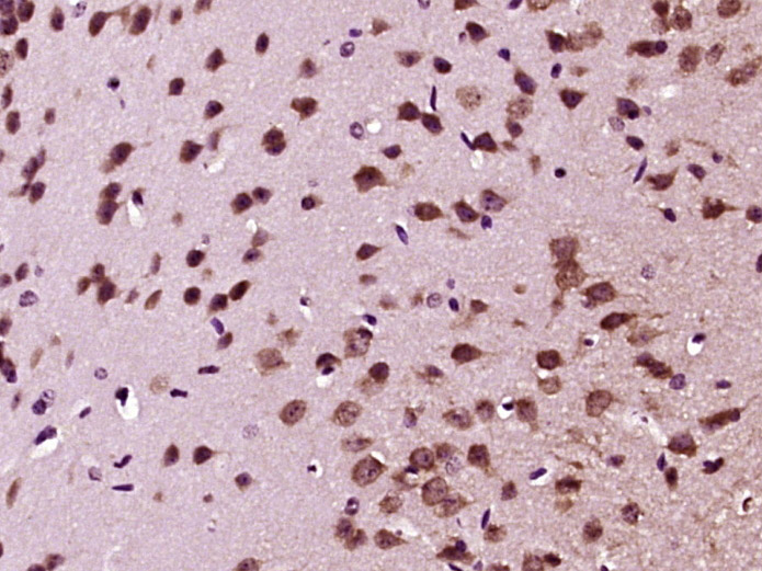 Paraformaldehyde-fixed, paraffin embedded mouse brain; Antigen retrieval by boiling in sodium citrate buffer (pH6) for 15min; Block endogenous peroxidase by 3% hydrogen peroxide for 30 minutes; Blocking buffer (normal goat serum) at 37°C for 20min; Antibody incubation with GDNF Polyclonal Antibody, Unconjugated (bs-1024R) at 1:400 overnight at 4°C, followed by a conjugated secondary and DAB staining.