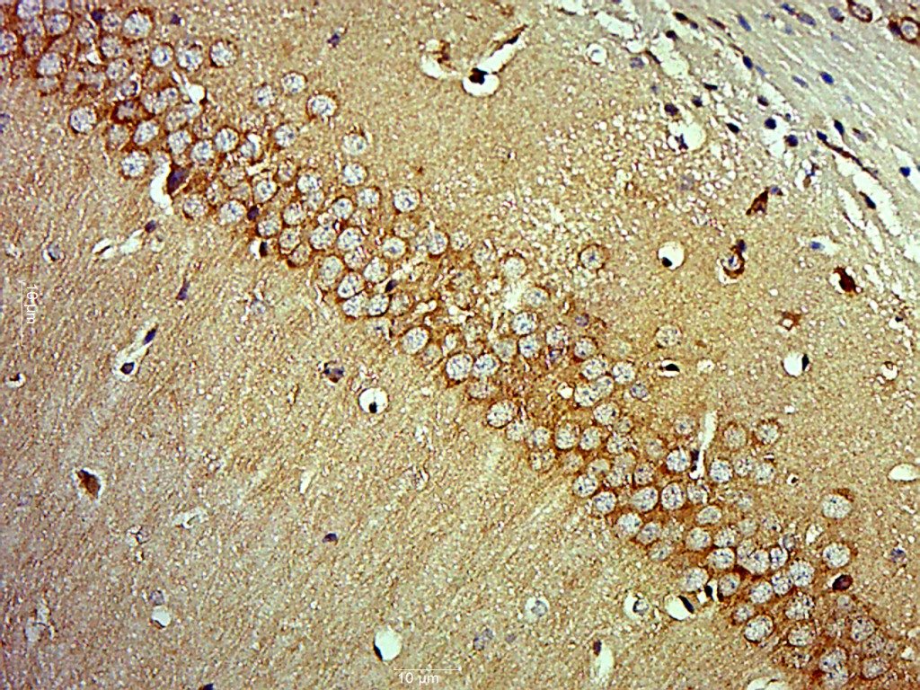 Paraformaldehyde-fixed, paraffin embedded mouse brain; Antigen retrieval by boiling in sodium citrate buffer (pH6) for 15min; Block endogenous peroxidase by 3% hydrogen peroxide for 30 minutes; Blocking buffer (normal goat serum) at 37°C for 20min; Antibody incubation with MAP3K13 Polyclonal Antibody (bs-18663R) at 1:400 overnight at 4°C, followed by a conjugated secondary and DAB staining.