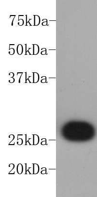 Jurkat cell lysate probed with BCL-2 (2C4) Monoclonal Antibody, Unconjugated (bsm-52022M) at 1:1000 overnight at 4˚C. Followed by a conjugated secondary antibody. Jurkat cell lysate probed with BCL-2 (2C4) Monoclonal Antibody, Unconjugated (bsm-52022M) at 1:1000 overnight at 4˚C. Followed by a conjugated secondary antibody.