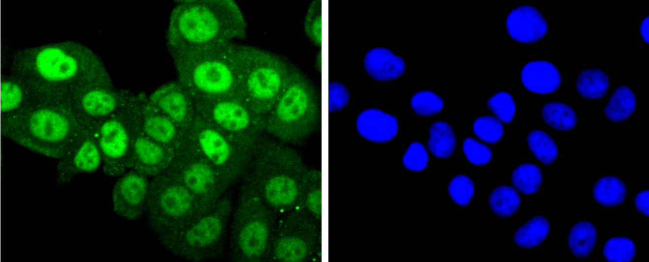 MCF-7 cells were fixed with paraformaldehyde, permeabilized with 0.25% Triton X-100 in PBS, blocked with 10% normal goat serum in PBS, and stained with PKC alpha(T638) (4B3) Monoclonal Antibody (bsm-52187R) at 1:200 in blocking solution. Slides were incubated overnight at 4\u00b0C followed by FITC conjugated secondary antibody inclubation. DAPI staining of the nucleus (blue)