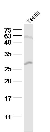Lane 1: Mouse testis lysates probed with StAR Polyclonal Antibody (bs-3570R) at 1:300 overnight at 4˚C. Followed by a conjugated secondary antibody at 1:5000 for 90 min at 37˚C.