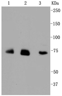 Lane 1: JAR lysates; Lane 2: HUVEC lysates; Lane 3: Hela lysates probed with Alas1 (1G11) Monoclonal Antibody (bsm-52012R) at 1:1000.