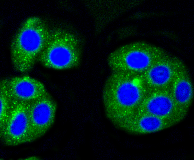 HepG2 cells were stained with Alas1 (1G11) Monoclonal Antibody (bsm-52012R) at 1:200 in PBS and incubated for overnight at 4C, followed by secondary antibody incubation, DAPI staining of the nuclei and detection HepG2 cells were stained with Alas1 (1G11) Monoclonal Antibody (bsm-52012R) at 1:200 in PBS and incubated for overnight at 4C, followed by secondary antibody incubation, DAPI staining of the nuclei and detection