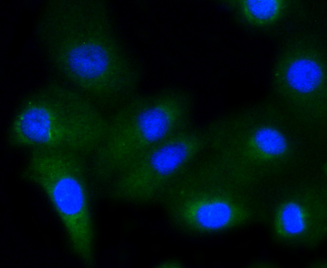 A549 cells were stained with Glycogen synthase 1(S641) (10C1) Monoclonal Antibody (bsm-52159R)  at 1:200 followed by secondary antibody incubation, DAPI staining of the nuclei and detection.